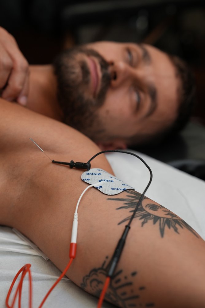 Aiguille de neuromodulation et électrodes — courant de basse intensité